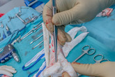 Díky 3D tisku preoperativních modelů si lékaři dokáží lépe vizualizovat operovanou část těla. Foto: KNL