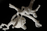 3D tisk slouží i k vizualizaci místního vyboulení cévy, neboli aneurysmatu. Foto: KNL