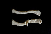 Díky 3D tisku anatomických nebo také preoperativních modelů si lékaři dokáží lépe vizualizovat část těla, kterou budou operovat. Foto: KNL