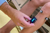 V Laboratoři pohybu se pomocí systému dvanácti kamer a reflexních terčíků nalepených na různých částech pacientova těla převádí nasnímaný pohyb do virtuálních modelů. Foto: KNL